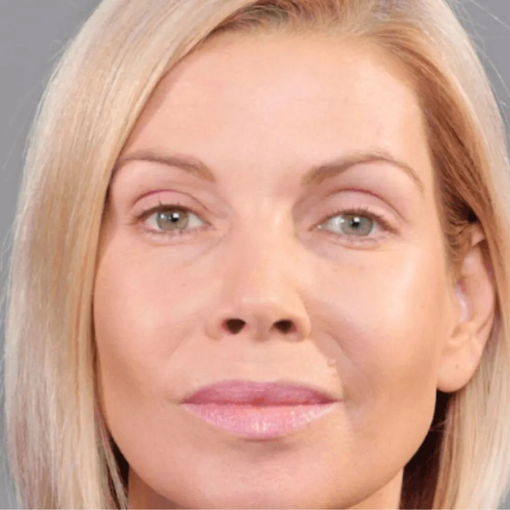 Kit levanta párpados LiftEyes ·🔥¡Oferta especial!